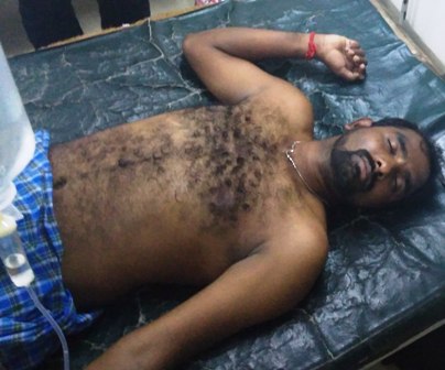 நிதி நிறுவன ஊழியர்கள் குடும்பத்தினருடன் தகராறு : மனமுடைந்த வாலிபர் விஷமருந்தி தற்கொலை முயற்சி : போலீஸ் விசாரணை