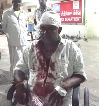 பெரம்பலூர் அருகே டிரைவருக்கு அரிவாள் வெட்டு: மற்றொரு சம்பவத்தில் பெண் உள்பட 3 பேர் மருத்துவமனையில் அனுமதி