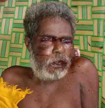 பெரம்பலூர் அருகே மகன் தாக்கியதால் தந்தை சாவு!